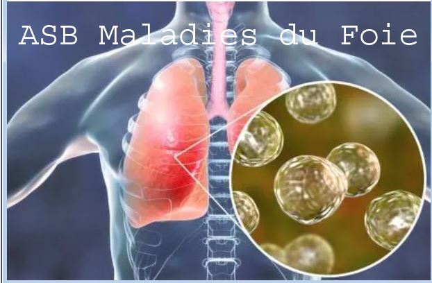 Fibrose Pulmonaire Traitement Naturel Soigner Naturellement La Fibrose Pulmonaire