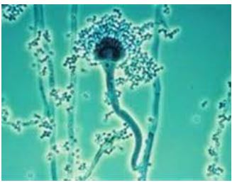 Campylobactériose Causes Traitement Naturel . Solution naturelle infection intestinal