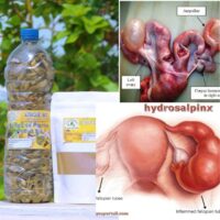 Tisane pour soigner l'Hydrosalpinx