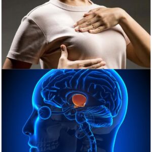 Hyperprolactinémie Traitement Naturel