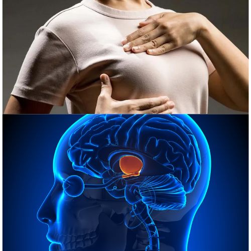 Hyperprolactinémie Traitement Naturel