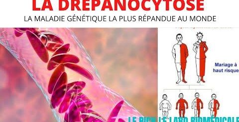 Drépanocytose Prévention Solution Naturelle