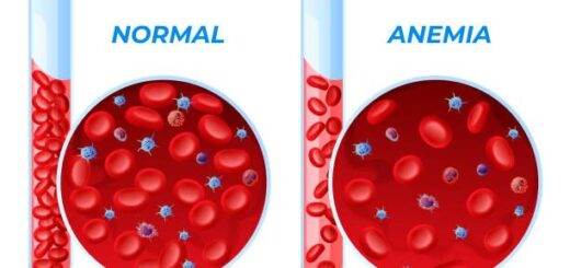 Anémie Traitement Naturel