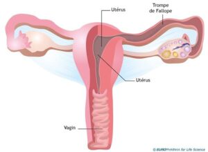 Comment Guérir la Salpingite