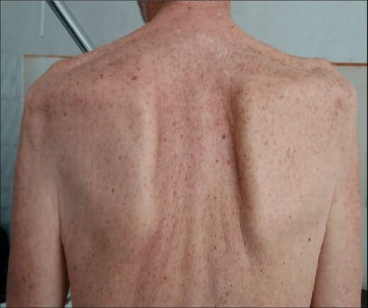 Solution Naturelle contre le Sida