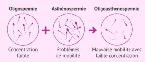 Produit Naturel pour L'Asthénospermie