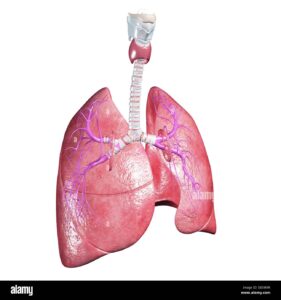 Embolie Pulmonaire