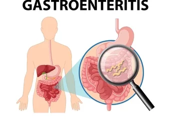 Gastro-entérite Causes Symptômes Prévention Traitement Naturel