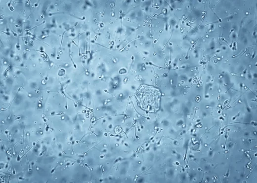 Asthénozoospermie Causes Conséquences et Remède Naturel