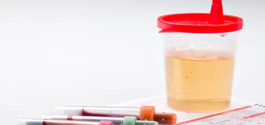 Hématurie Causes Symptômes Solution naturelle