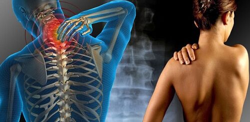 Fibromyalgie Causes Symptômes Solution Naturelle pour une Fibromyalgie