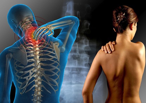 Fibromyalgie Causes Symptômes Solution Naturelle pour une Fibromyalgie