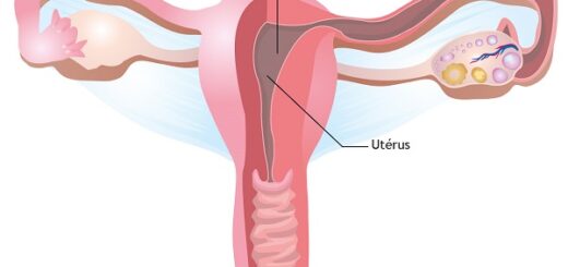 Salpingite Causes Symptômes Complications Thérapie Naturelle