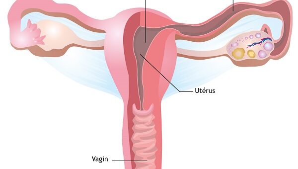 Salpingite Causes Symptômes Complications Thérapie Naturelle