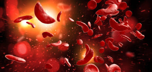 Drépanocytose Causes Symptômes Traitement Naturel de la Drépanocytose
