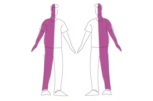 Hémiplégie Causes Conséquences Complications Solution Naturelle