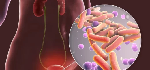 Cystite Causes Symptômes Prévention Traitement Naturel Sûr de la Cystite
