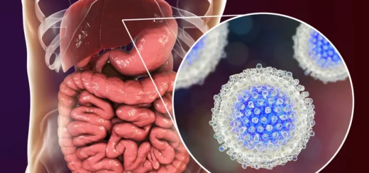 Hépatite C Causes Symptômes Prévention Solution Naturelle Sûr