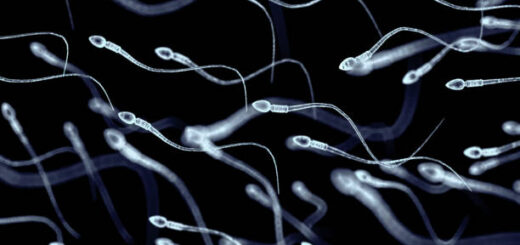 Hyperspermie Causes Symptômes Traitement Naturel Sûr contre l' hyperspermie