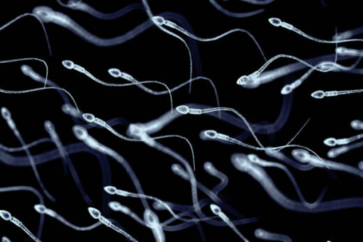 Hyperspermie Causes Symptômes Traitement Naturel Sûr contre l' hyperspermie
