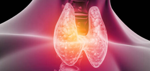 Hyperthyroïdie Causes Symptômes Traitement Naturel Sûr contre la Goitre