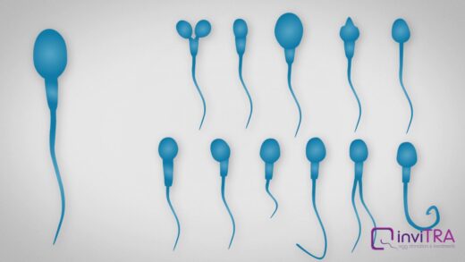 Tératospermie Causes Symptômes Traitement Naturel Sûr de la Tératospermie