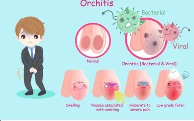 Épididymo-orchite Causes Symptômes Prévention Traitement Naturel