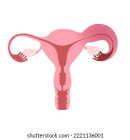 Hydrosalpinx Causes Symptômes Traitement Naturel de l' Hydrosalpinx