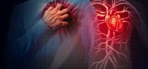 Infarctus du Myocarde Causes Symptômes Prévention Traitement Naturel