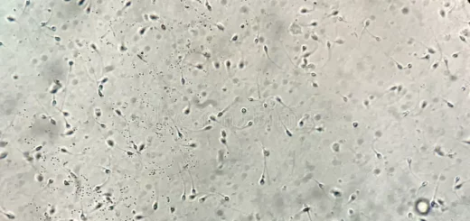 Comment Soigner Naturellement une Asthénospermie par les Plantes Médicinales ?