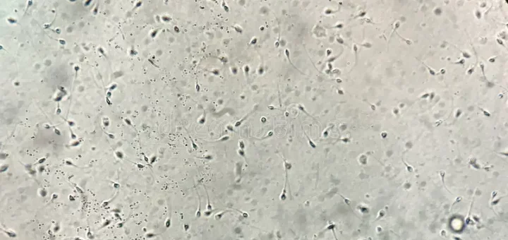 Comment Soigner Naturellement une Asthénospermie par les Plantes Médicinales ?