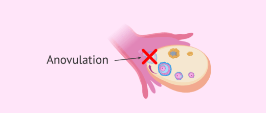 Anovulation Causes Symptômes Traitement Naturel de l' anovulation