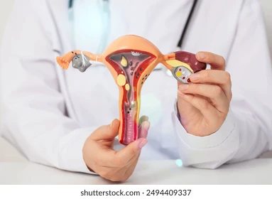 Comment Soigner Naturellement un Kyste Ovarien par les Plantes ?