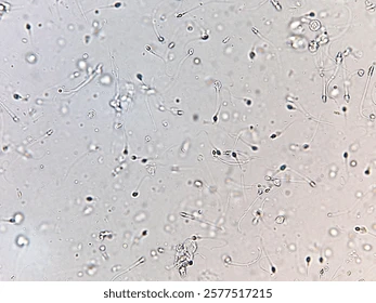 Comment Traiter Naturellement une Azoospermie Sévère ?