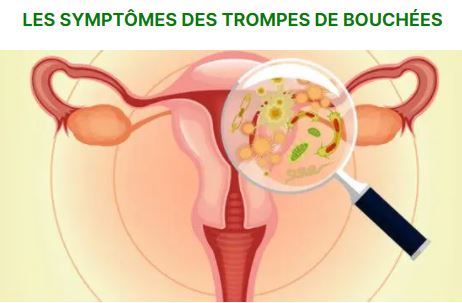 Phimosis Tubaire Bilatéral Causes Symptômes Traitement Naturel