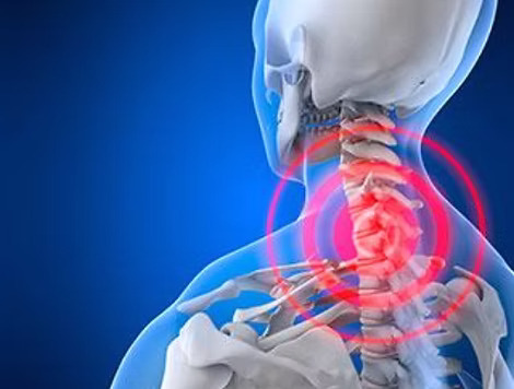 Maladie de Forestier Causes Symptômes Traitement Naturel